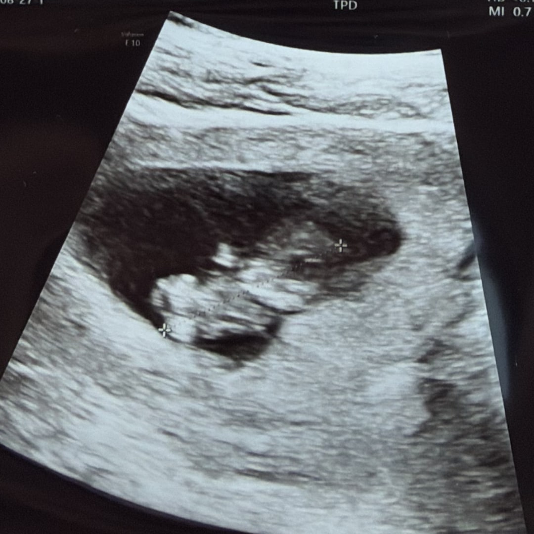 Photo shared by Cole for their Babylist baby registry.