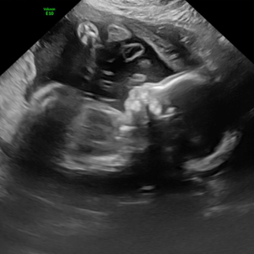 Photo shared by Christa for their Babylist baby registry.