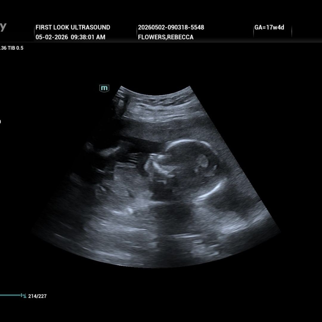 Photo shared by Rebecca for their Babylist baby registry.