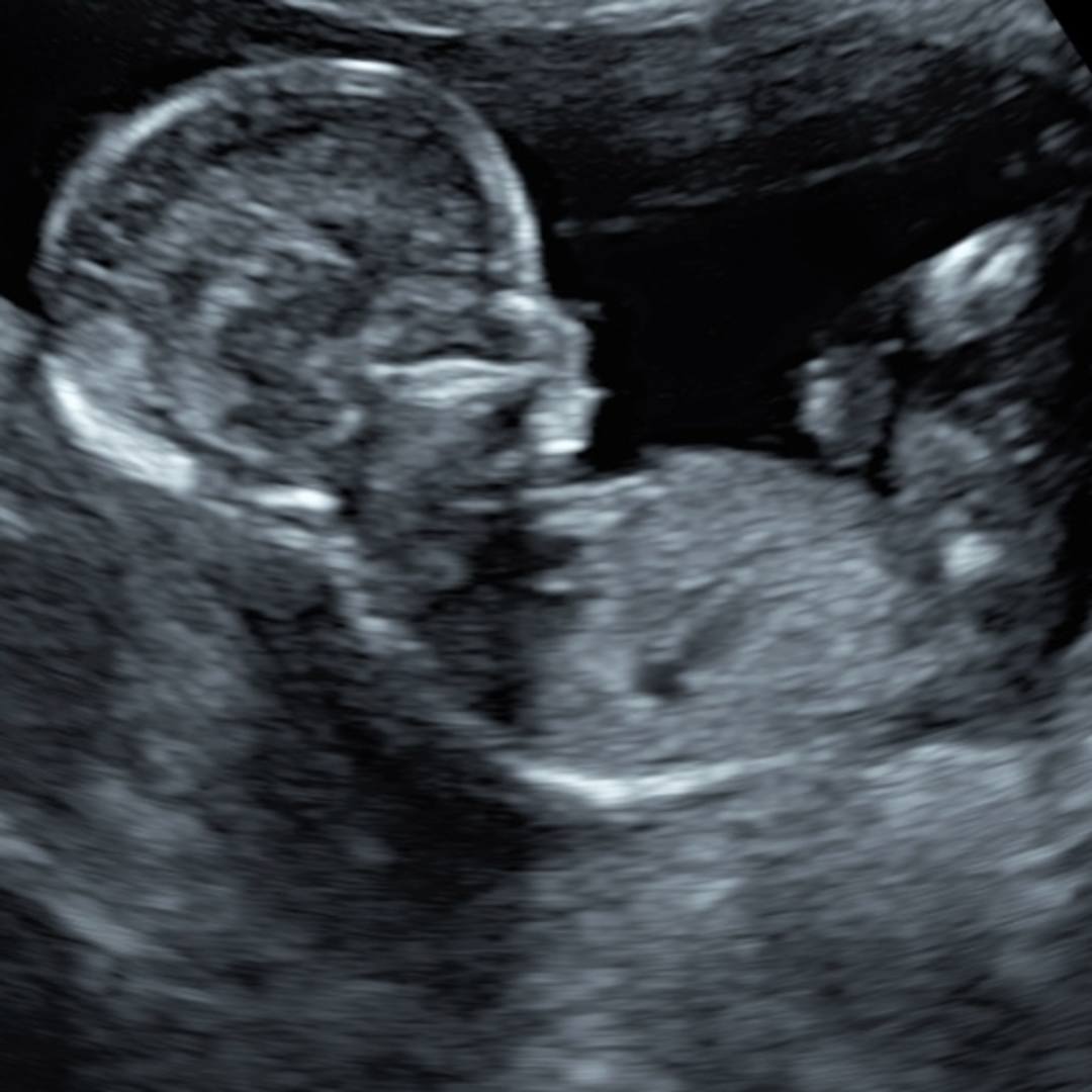 Photo shared by Andi for their Babylist baby registry.