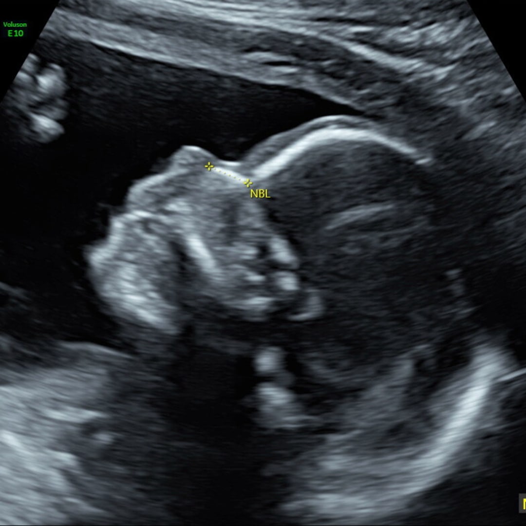 Photo shared by Sarah for their Babylist baby registry.