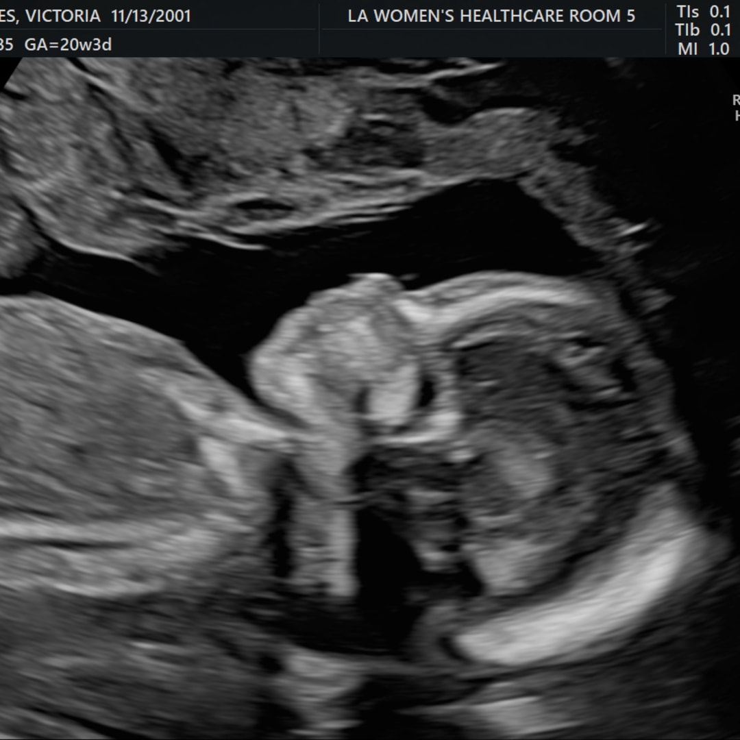 Photo shared by Victoria for their Babylist baby registry.