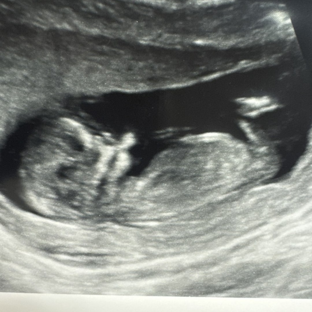 Photo shared by Jennifer for their Babylist baby registry.