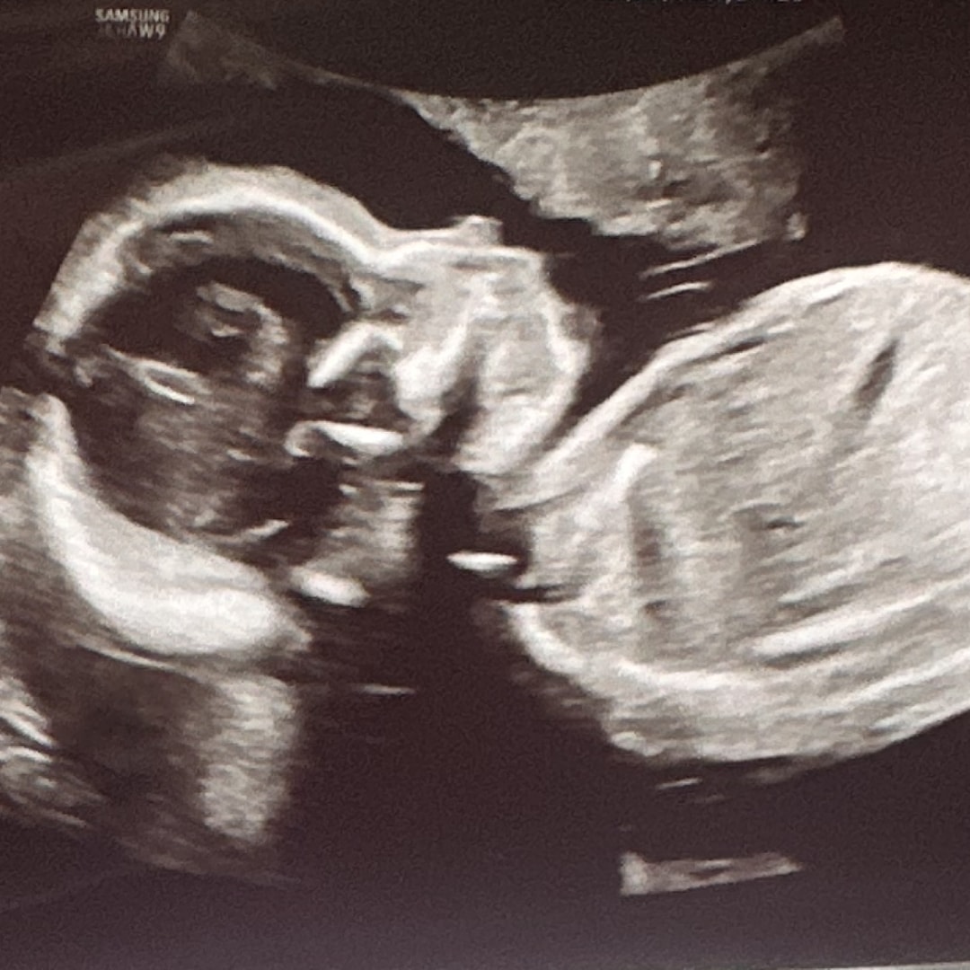 Photo shared by Katie for their Babylist baby registry.