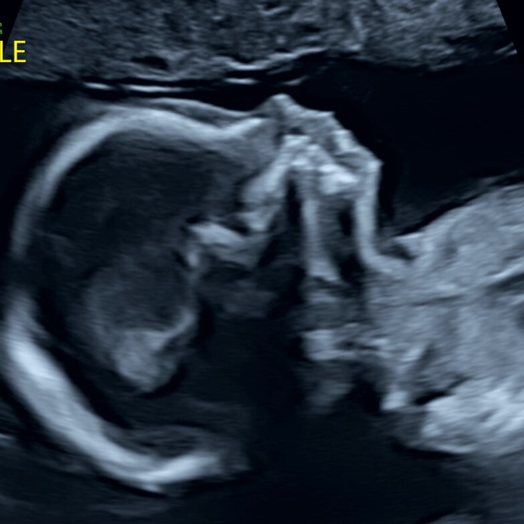 Photo shared by Nickolas for their Babylist baby registry.