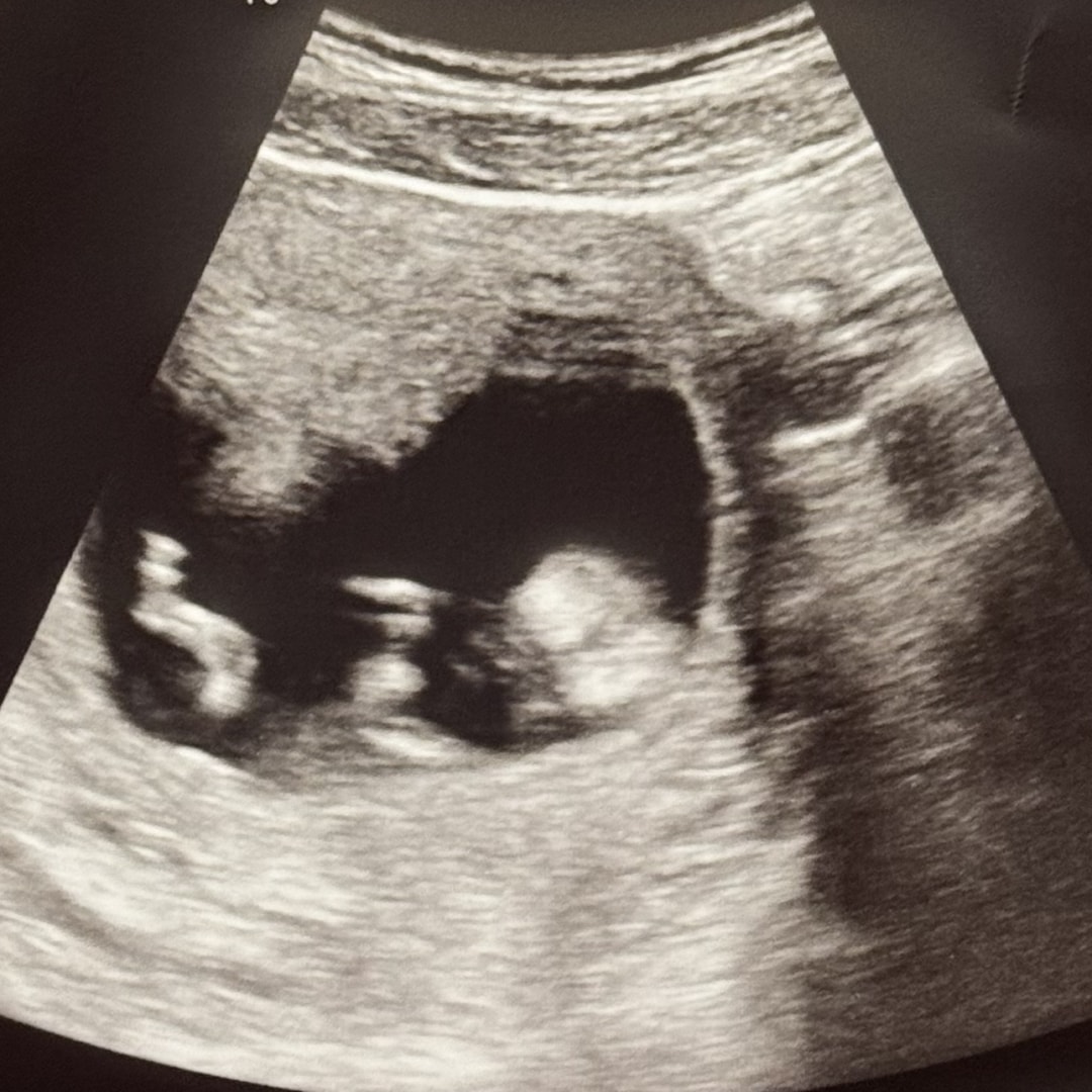 Photo shared by Brittney for their Babylist baby registry.