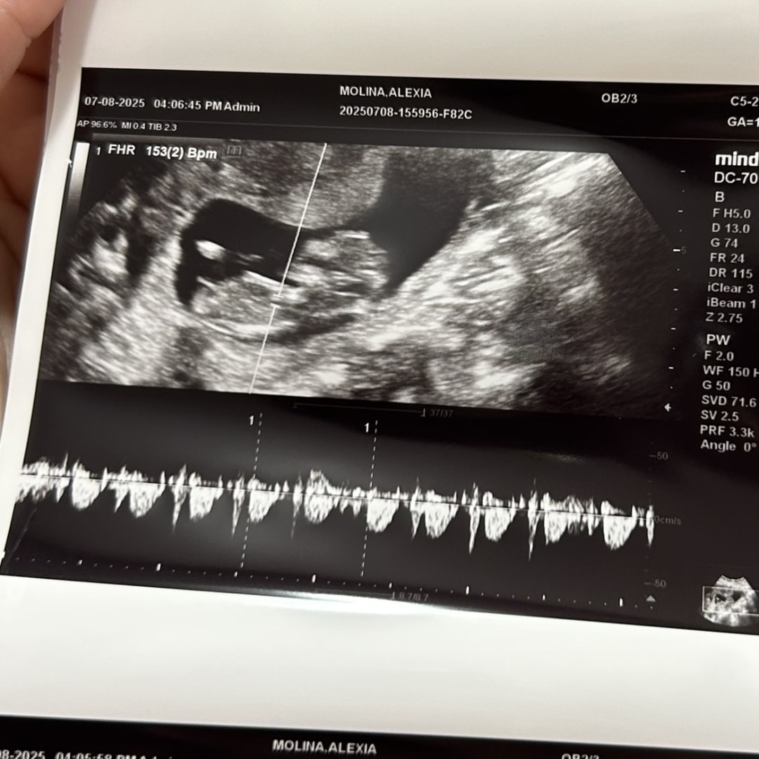 Photo shared by Alexia for their Babylist baby registry.
