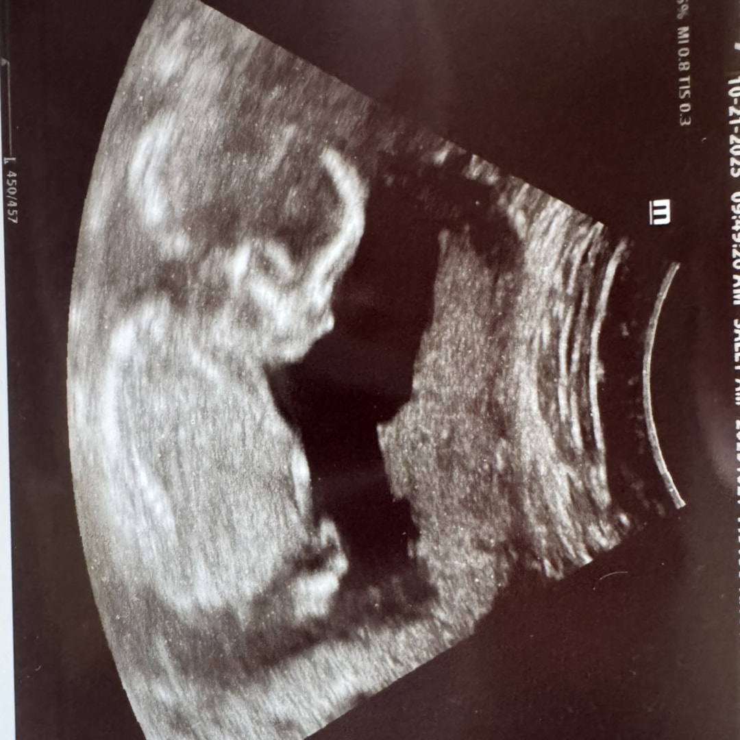 Photo shared by Heather for their Babylist baby registry.