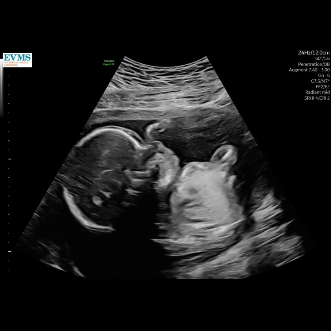 Photo shared by Lauryn for their Babylist baby registry.