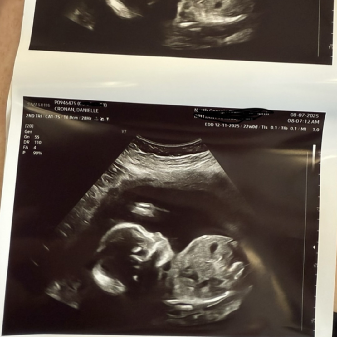 Photo shared by Danielle for their Babylist baby registry.