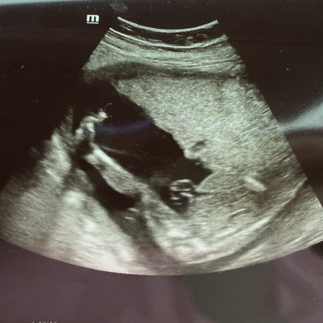 Photo shared by Lexi for their Babylist baby registry.