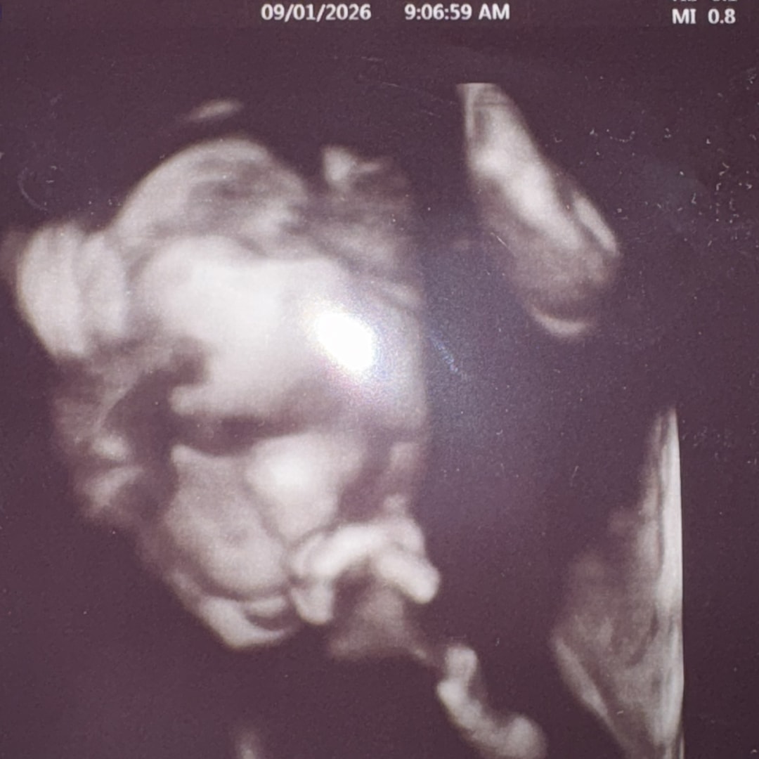 Photo shared by Cecily for their Babylist baby registry.