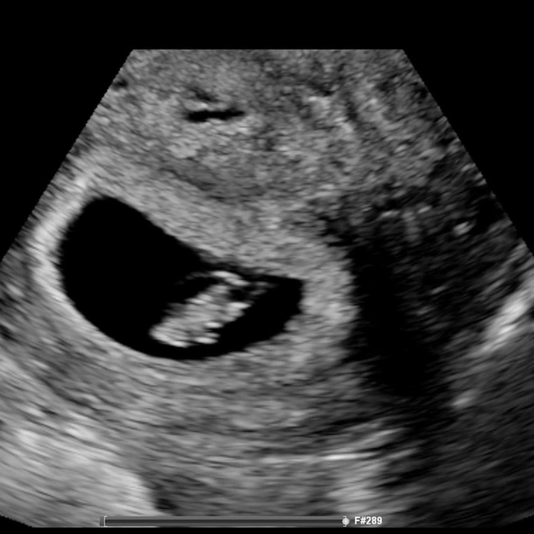 Photo shared by Kelsey for their Babylist baby registry.