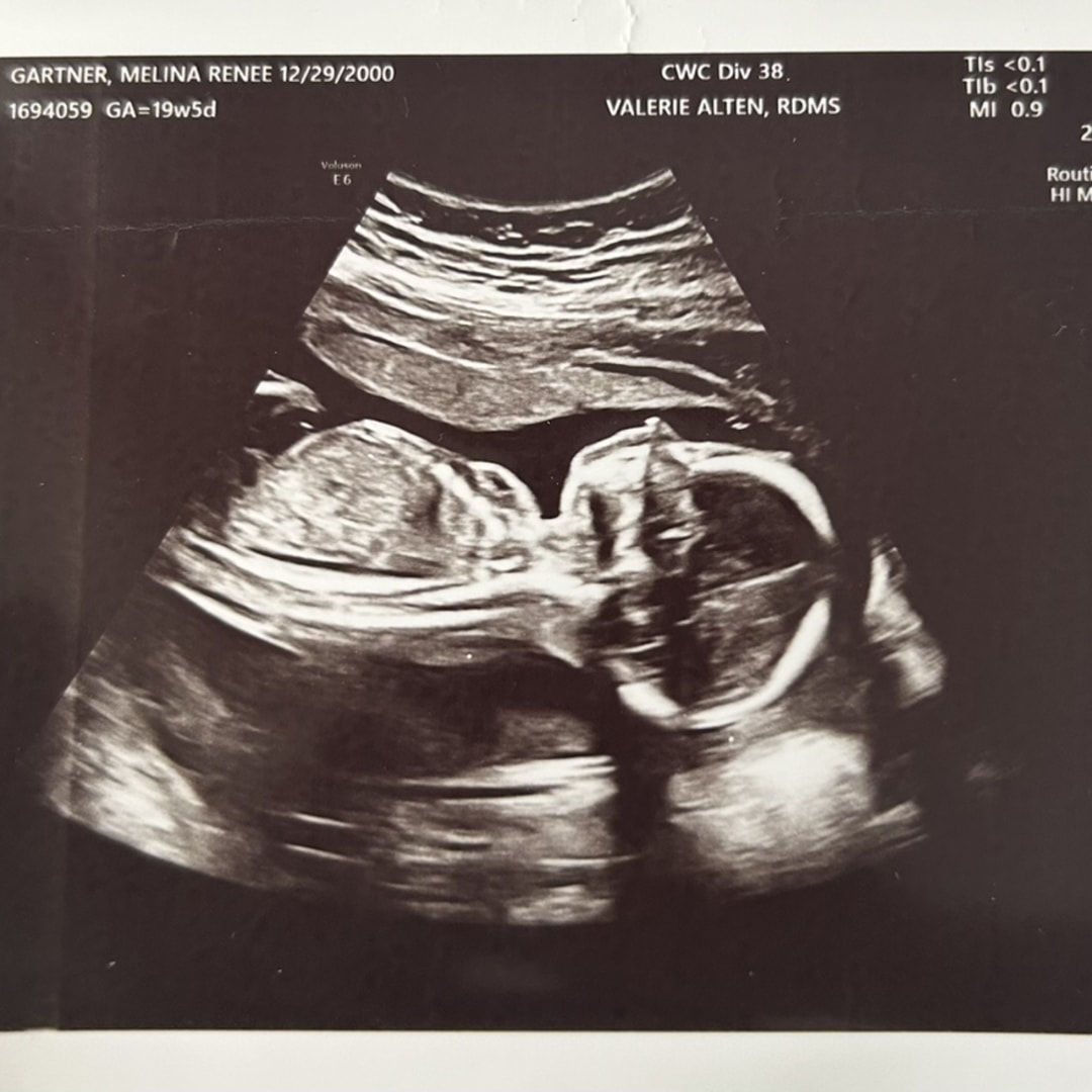 Photo shared by Melina for their Babylist baby registry.