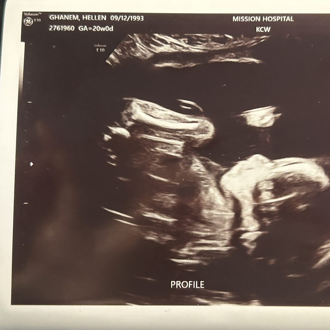 Photo shared by Hellen for their Babylist baby registry.