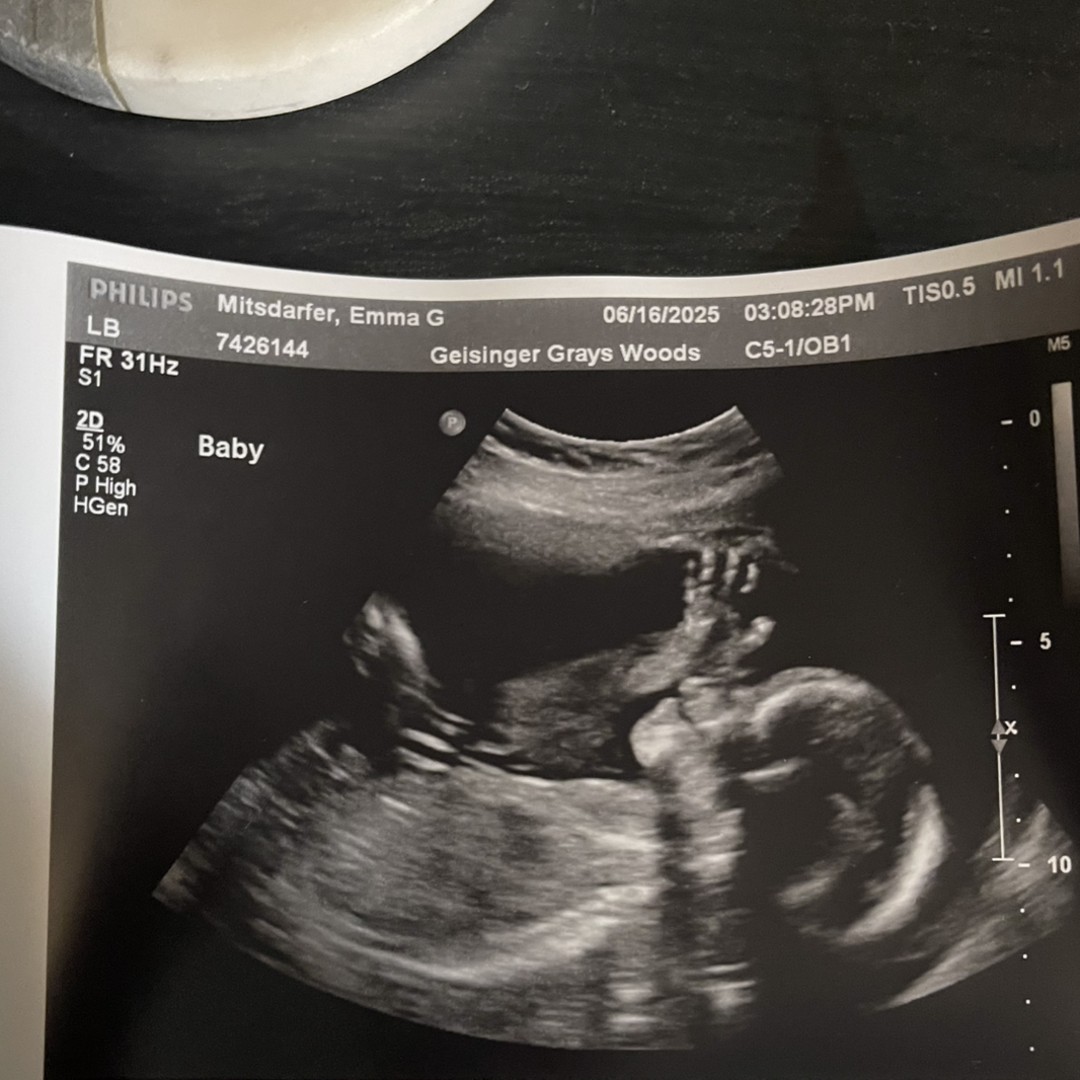 Photo shared by Emma for their Babylist baby registry.