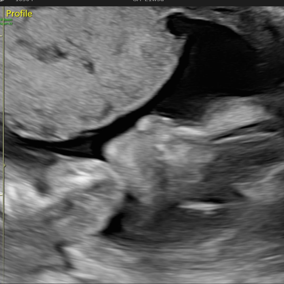 Photo shared by Ana Maria for their Babylist baby registry.