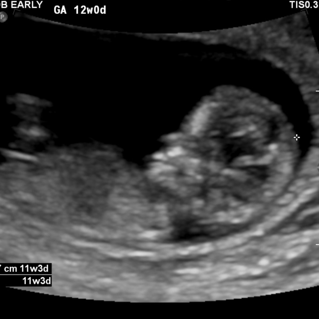 Photo shared by Ariyanna for their Babylist baby registry.