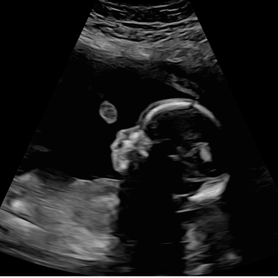 Photo shared by Brianna for their Babylist baby registry.