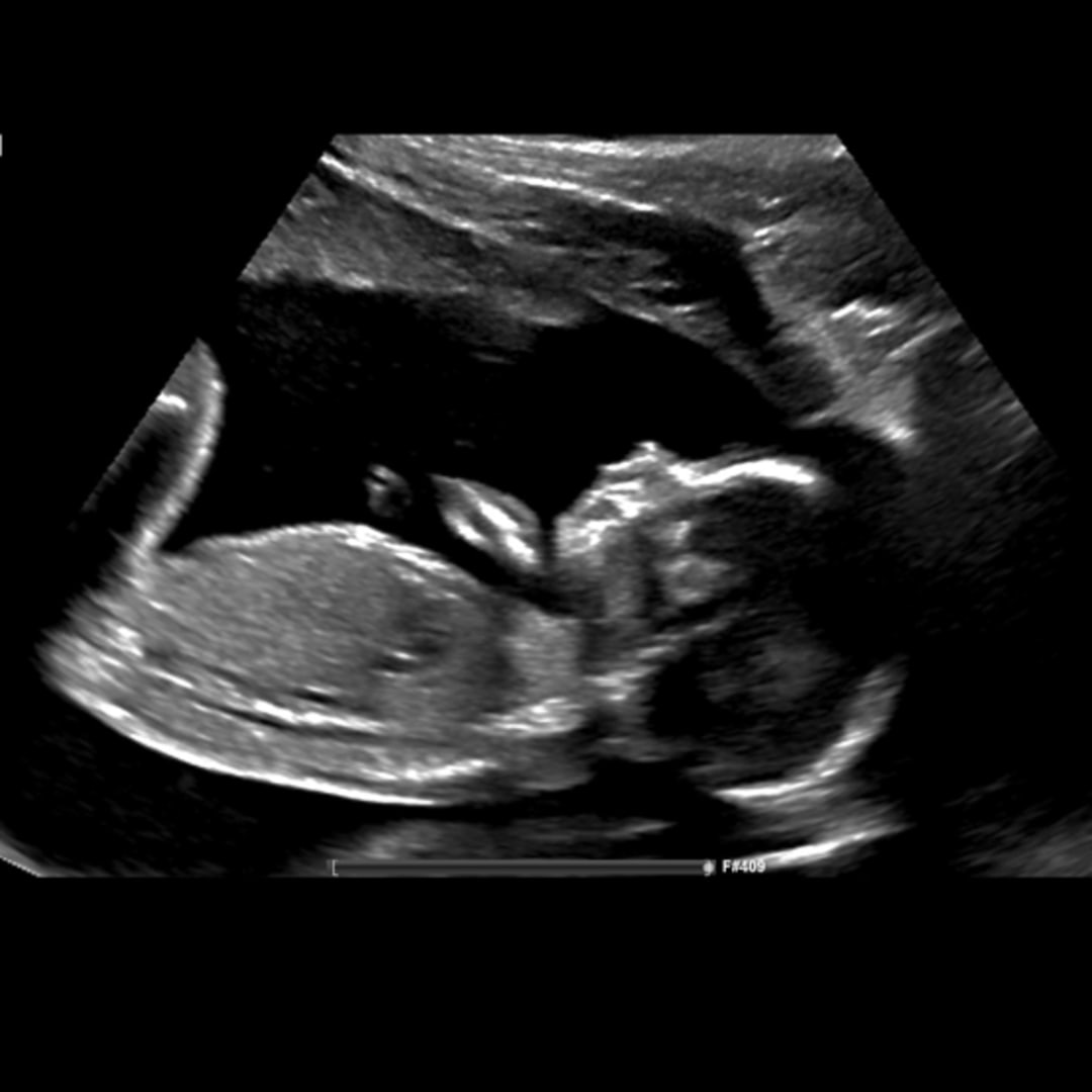 Photo shared by Erica for their Babylist baby registry.