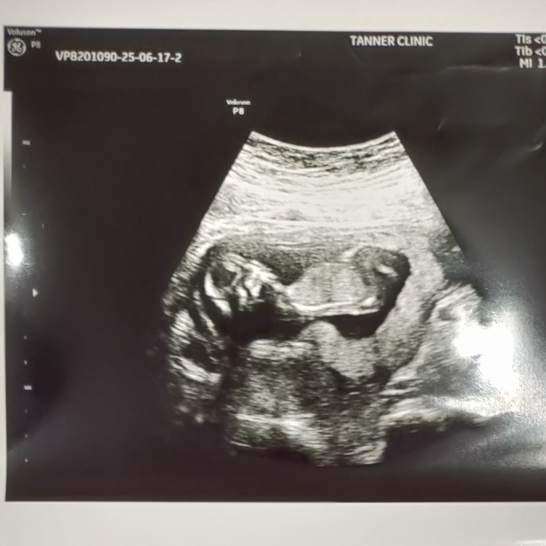 Photo shared by Anna for their Babylist baby registry.