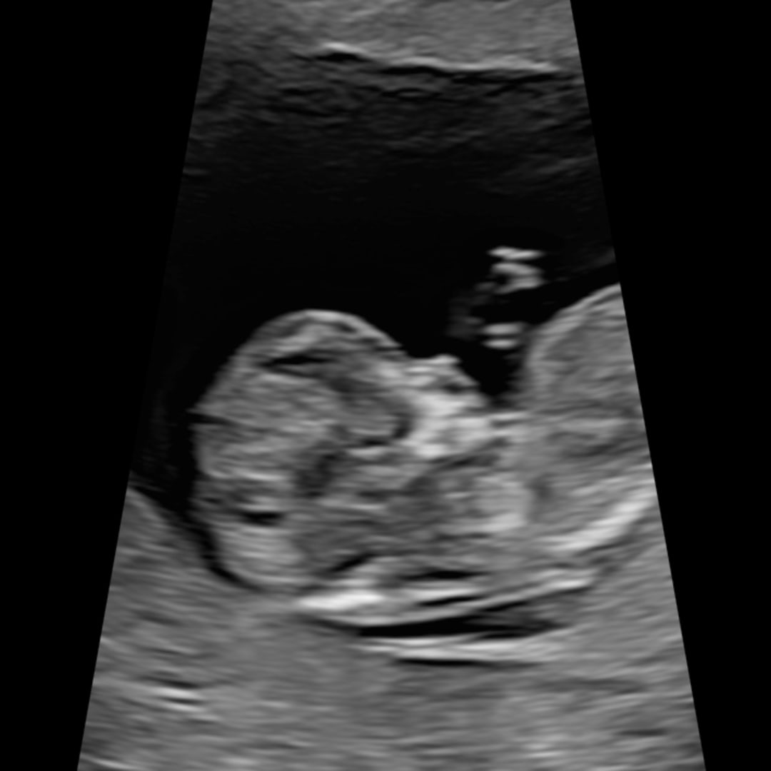 Photo shared by Alisha for their Babylist baby registry.