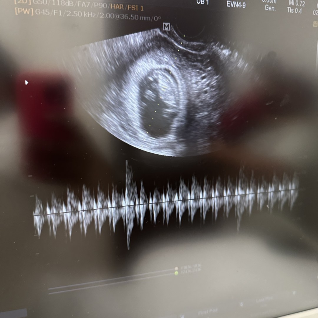 Photo shared by Elizabeth for their Babylist baby registry.