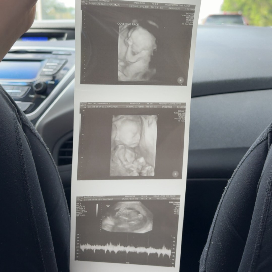 Photo shared by Savannah for their Babylist baby registry.