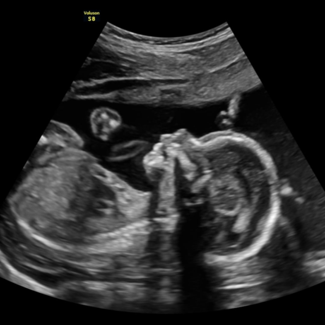 Photo shared by Hailey for their Babylist baby registry.