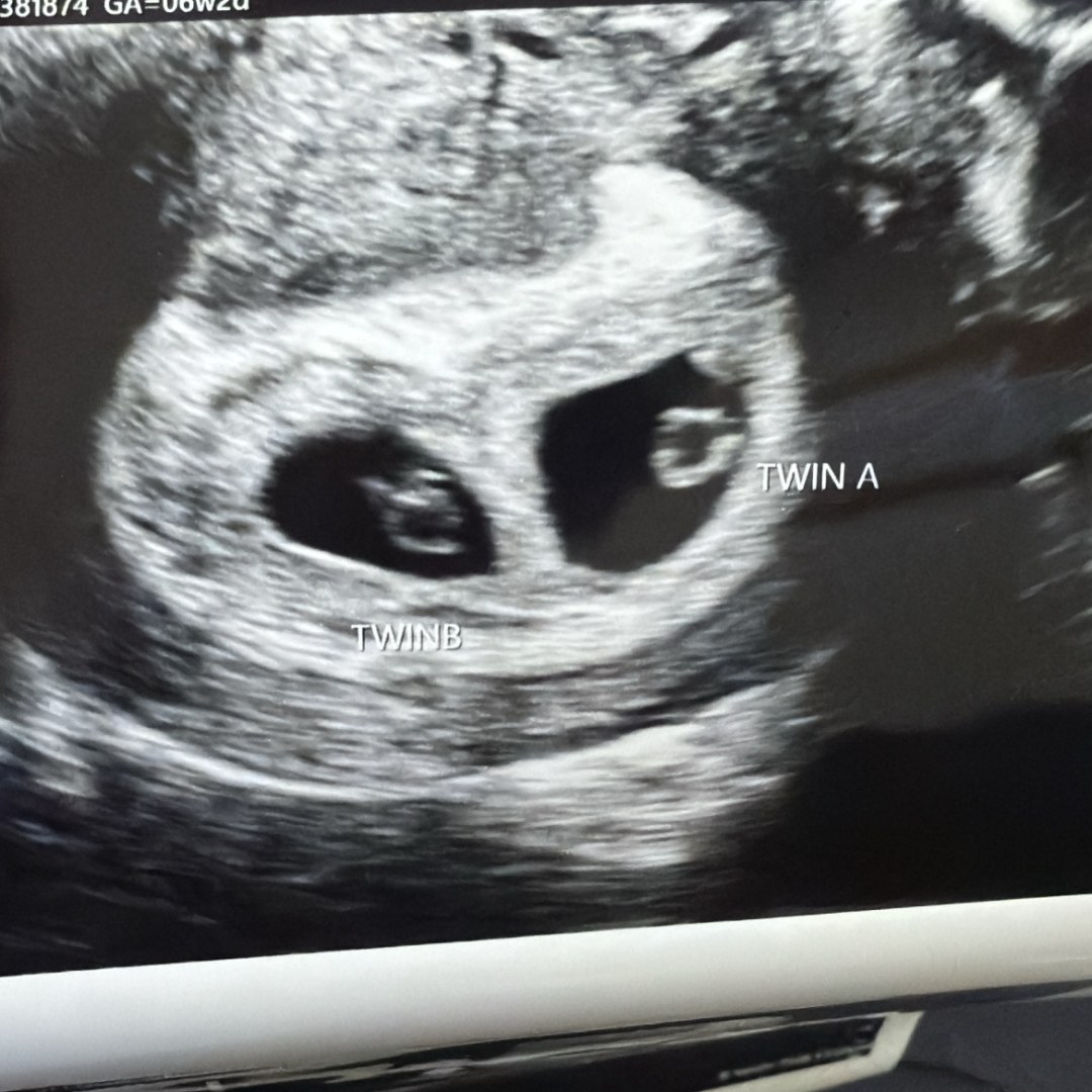 Photo shared by A’najaha for their Babylist baby registry.