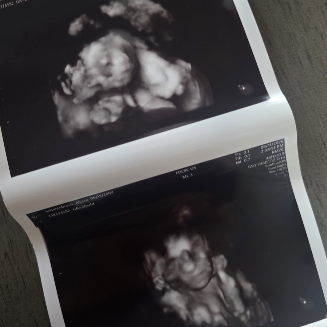 Photo shared by Alyssa for their Babylist baby registry.