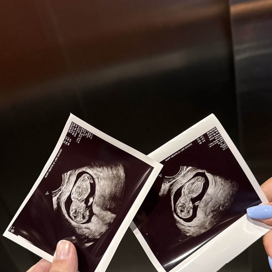 Photo shared by Casey for their Babylist baby registry.