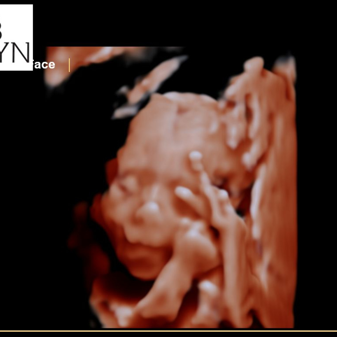 Photo shared by David and Jazmarie for their Babylist baby registry.