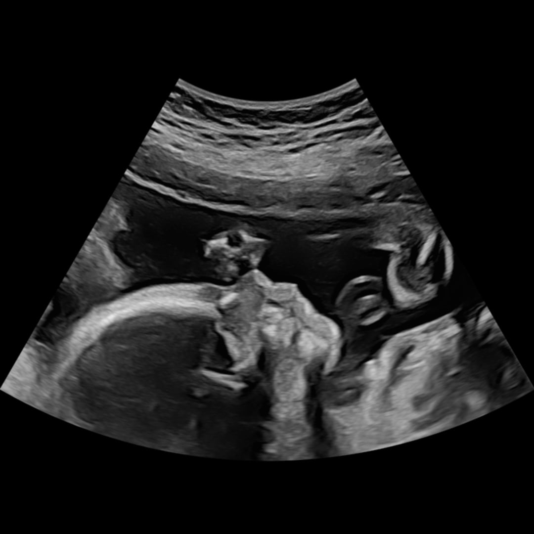 Photo shared by Jolene for their Babylist baby registry.