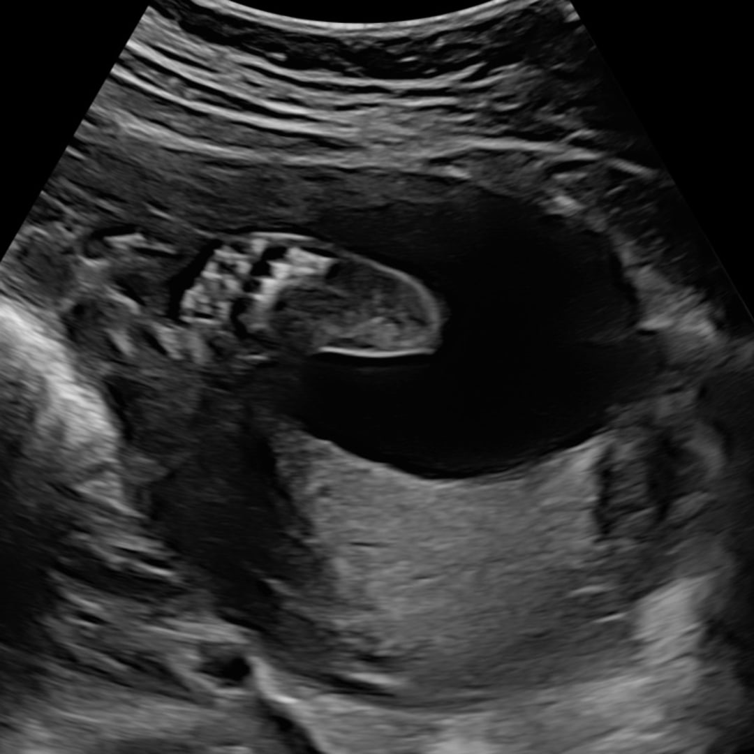 Photo shared by Kaiya for their Babylist baby registry.