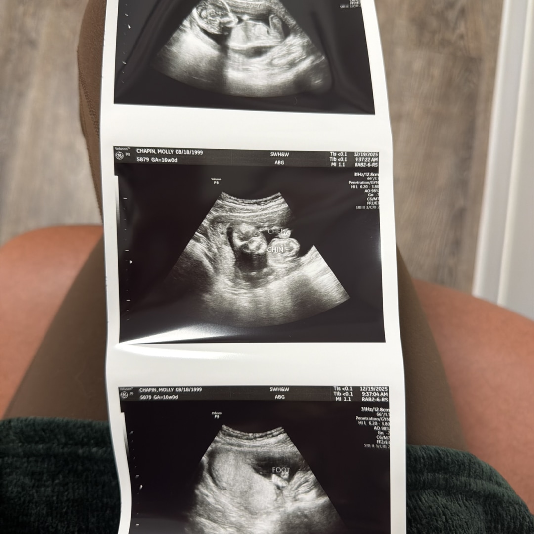 Photo shared by Molly for their Babylist baby registry.