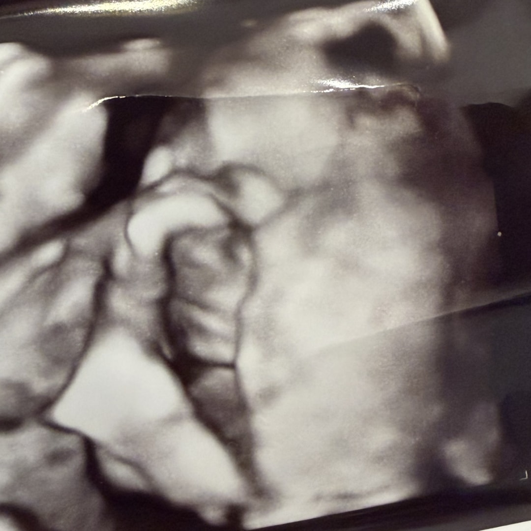 Photo shared by Hannah for their Babylist baby registry.