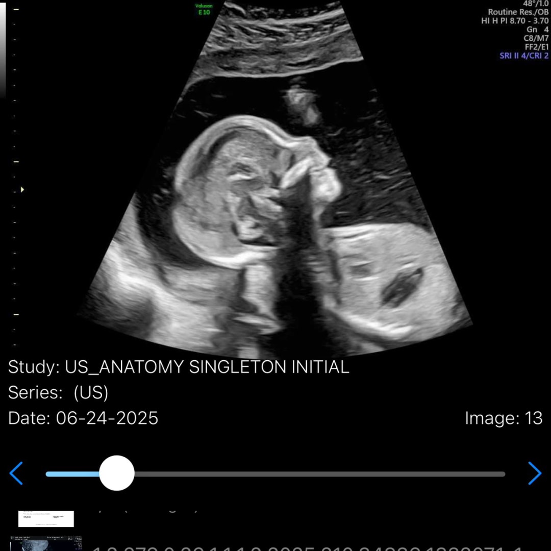 Photo shared by Kaylee for their Babylist baby registry.