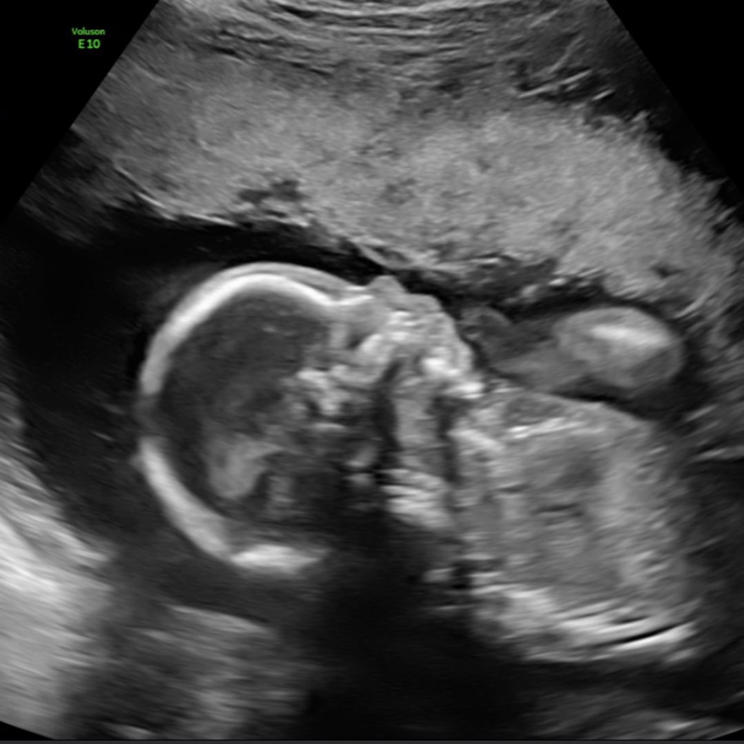 Photo shared by Alexia for their Babylist baby registry.