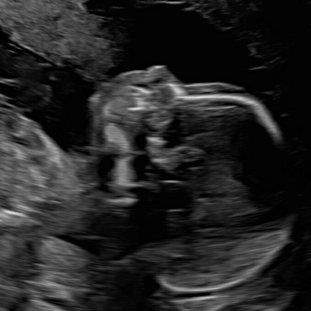 Photo shared by Hannah for their Babylist baby registry.