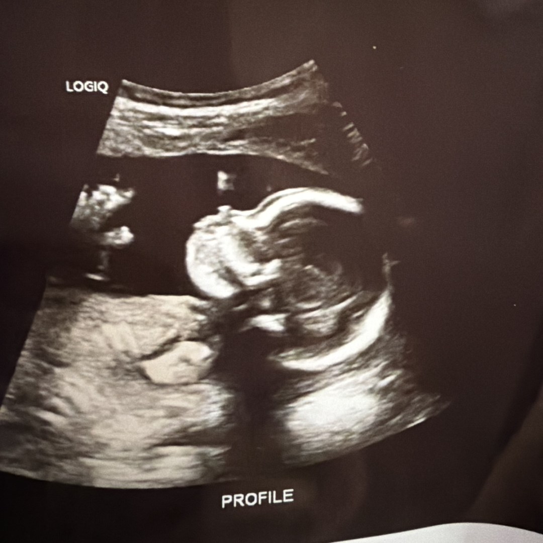 Photo shared by Rebecca for their Babylist baby registry.