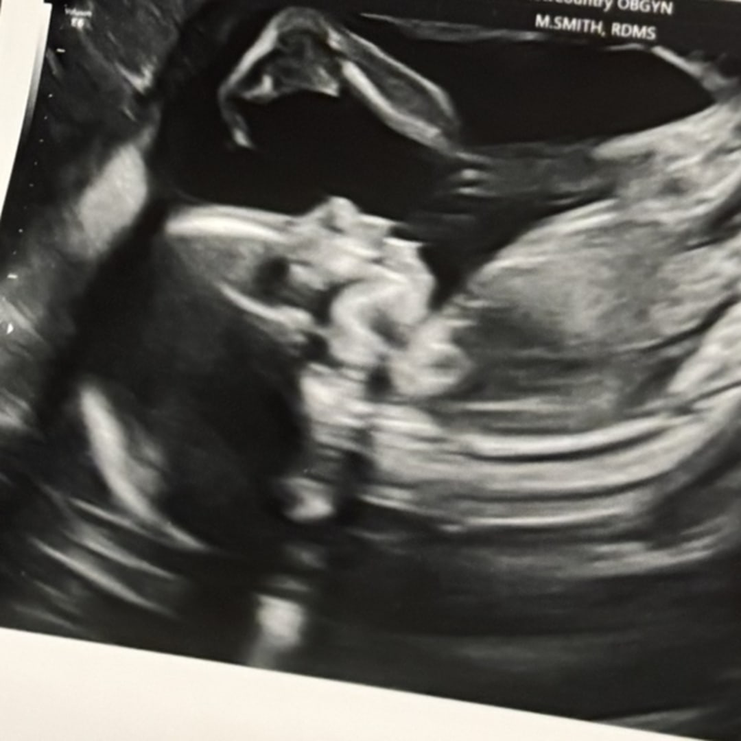 Photo shared by Hailey for their Babylist baby registry.