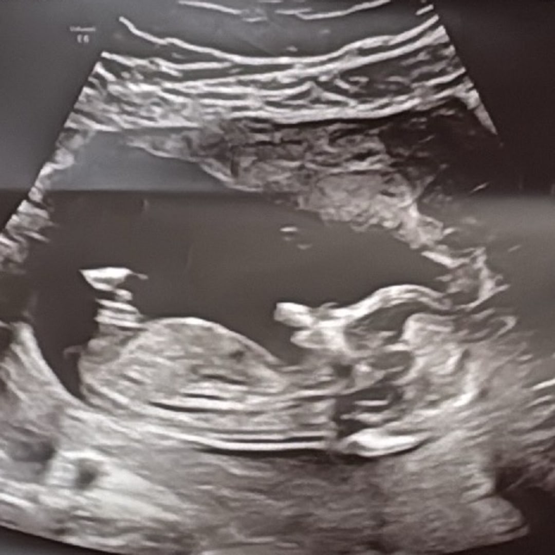 Photo shared by Alyona for their Babylist baby registry.
