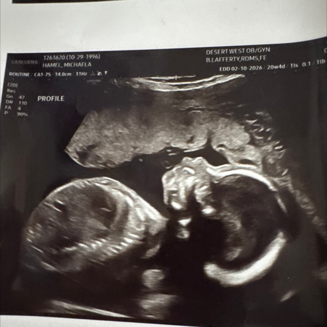 Photo shared by Michaela for their Babylist baby registry.