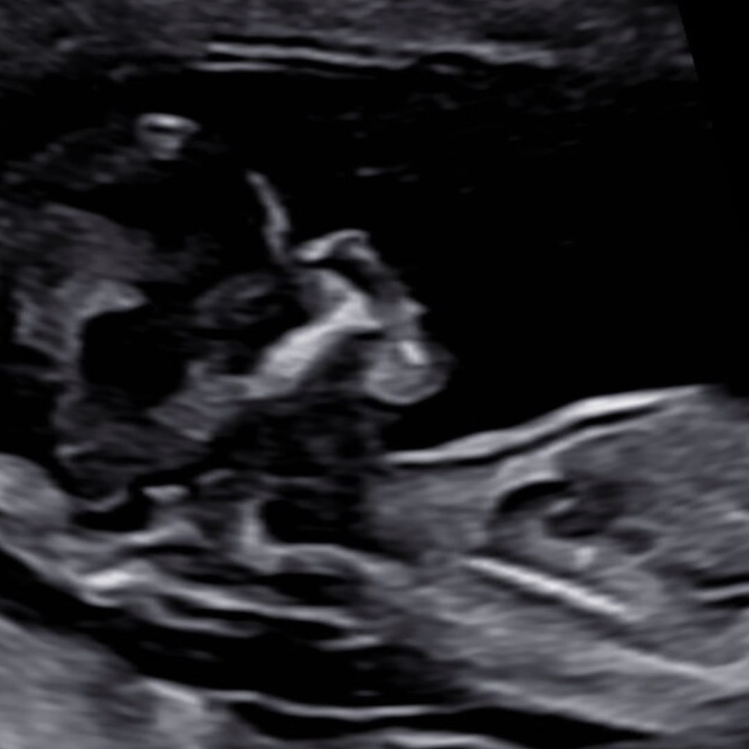 Photo shared by Kori for their Babylist baby registry.