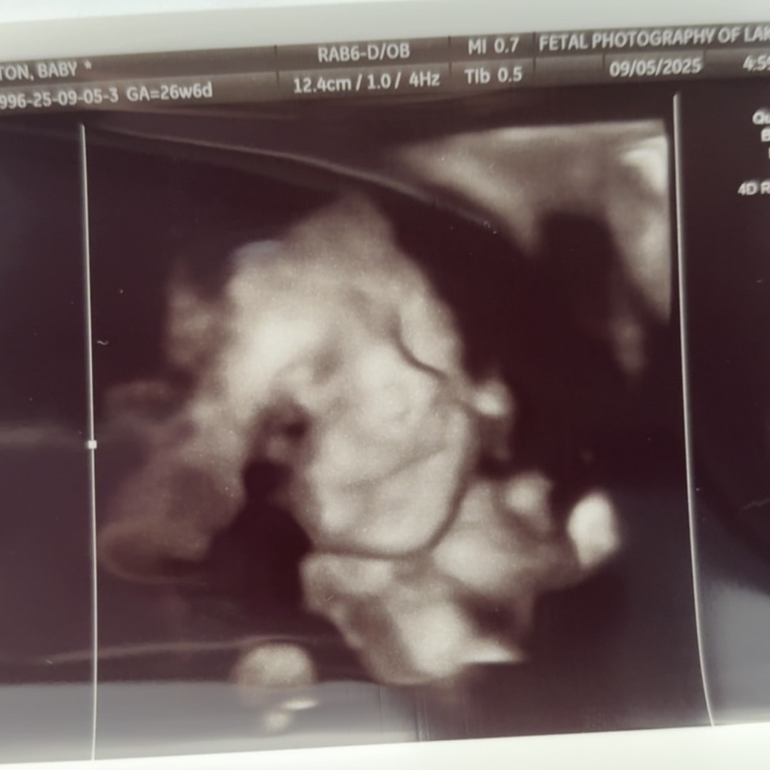 Photo shared by Hazlee for their Babylist baby registry.