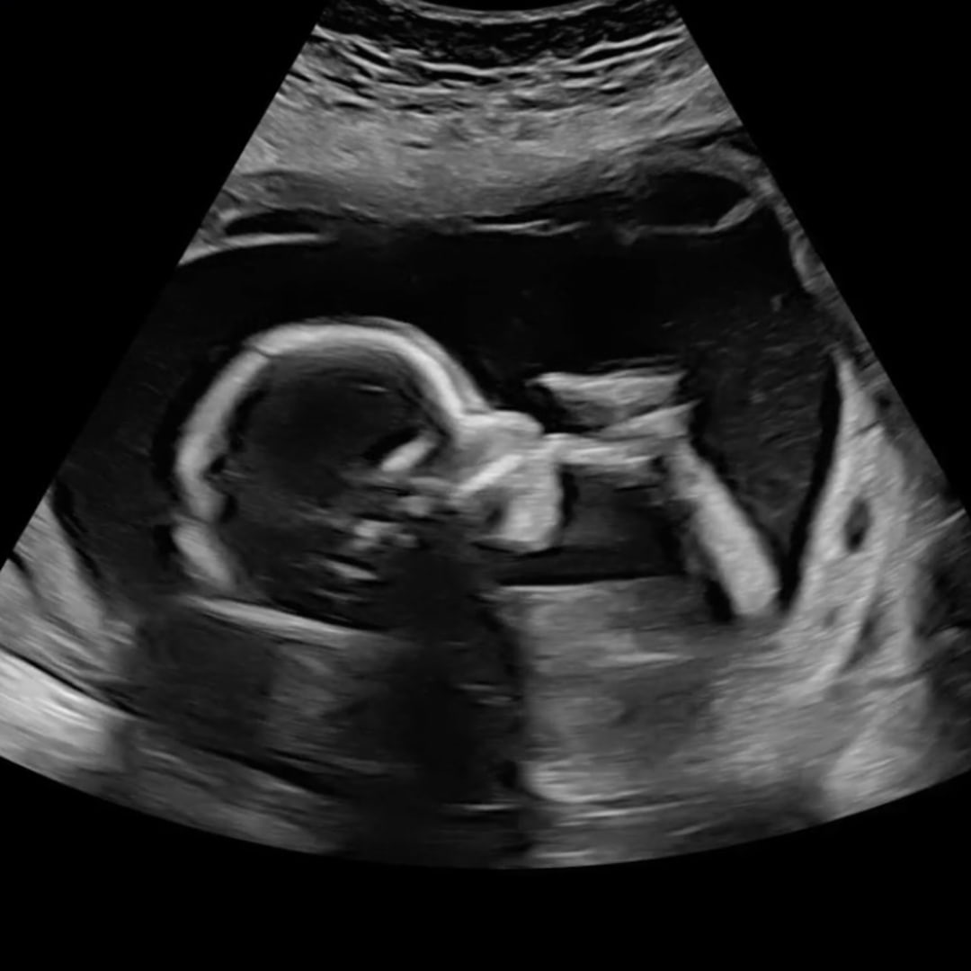 Photo shared by Liz for their Babylist baby registry.