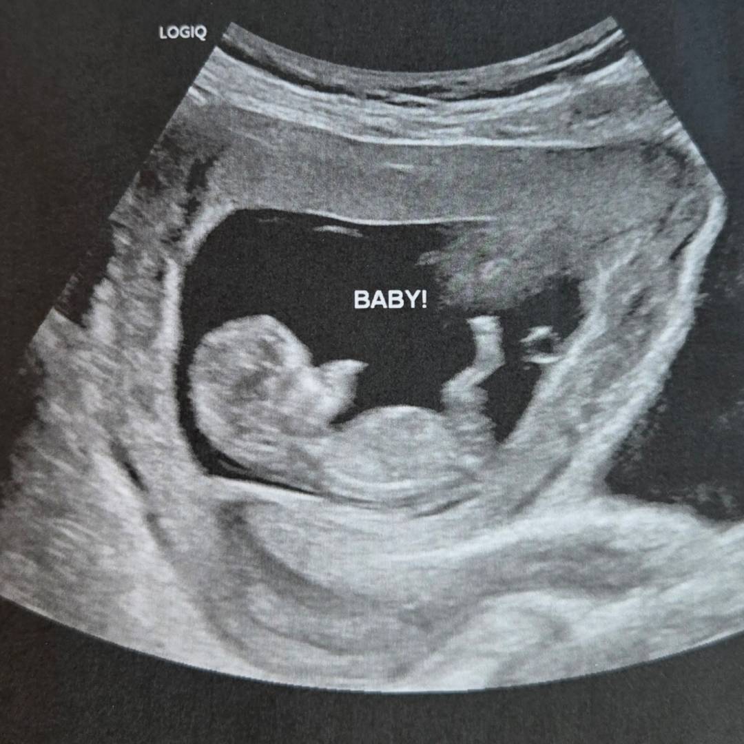 Photo shared by Alex for their Babylist baby registry.