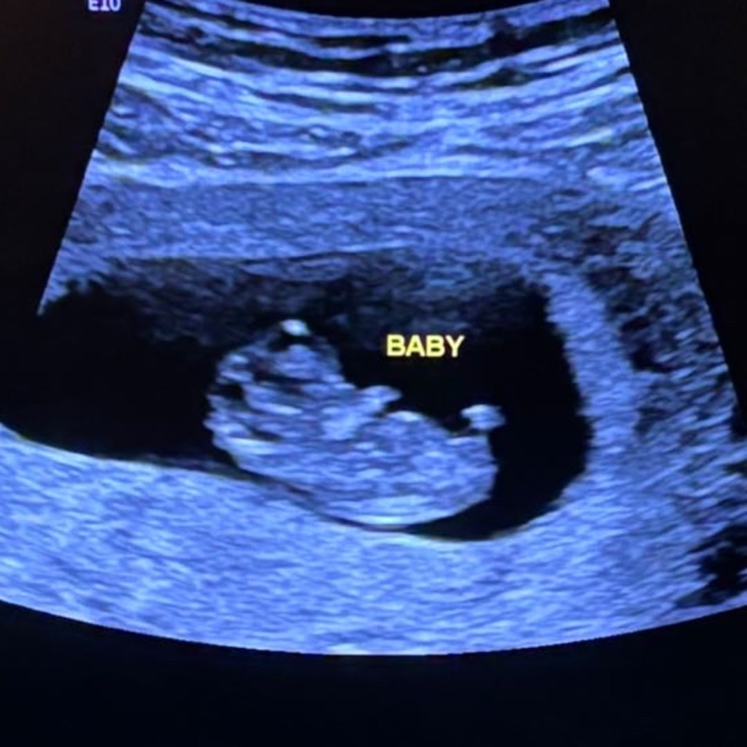 Photo shared by Lauren for their Babylist baby registry.