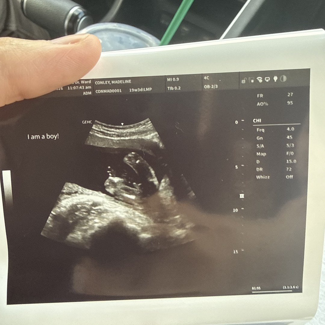Photo shared by Madeline for their Babylist baby registry.